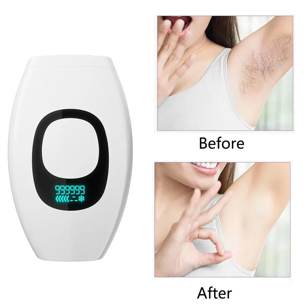 999,999 Flashes IPL Epilator – Painless Laser Hair Removal for Bikini & Facial, Professional Depilator Device with LCD Display