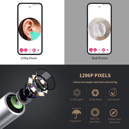 Smart Visual Ear Cleaner with Camera – 1296P Ear Wax Removal Tool with USB-C Charging & 6 LED Lights