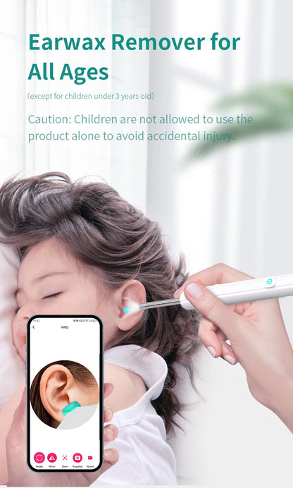 Smart Visual Ear Cleaner with Camera – 1296P Ear Wax Removal Tool with USB-C Charging & 6 LED Lights